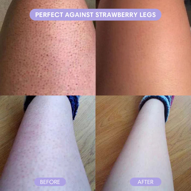 Magic Hair Eraser - Laser Removal At Home